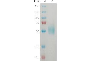 Interleukin 1 Receptor-Like 1 (IL1RL1) (AA 19-328) protein (His tag)