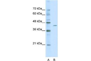 WB Suggested Anti-ZBTB26 Antibody Titration:  0. (ZBTB26 antibody  (Middle Region))