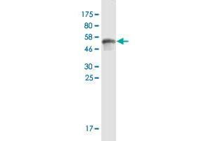 Western Blotting (WB) image for anti-serpin Peptidase Inhibitor, Clade B (Ovalbumin), Member 5 (SERPINB5) (AA 1-231) antibody (ABIN2565883)