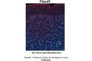 Sample Type :  Adult mouse cortex  Primary Antibody Dilution :  1:750  Secondary Antibody :  Anti-rabbit-Cy3  Secondary Antibody Dilution :  1:1000  Color/Signal Descriptions :  Red: Fibcd1 Cyan: Nissl(Neurons)  Gene Name :  FIBCD1  Submitted by :  Joshua R. (FIBCD1 antibody  (C-Term))