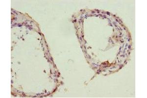 Immunohistochemistry of paraffin-embedded human testis tissue using ABIN7176735 at dilution of 1:100 (ZWINT antibody  (AA 1-277))