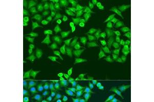 Immunofluorescence analysis of U2OS cells using RRM1 Polyclonal Antibody at dilution of 1:100. (RRM1 antibody)