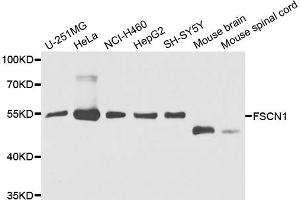 Western blot analysis of extracts of various cell lines, using FSCN1 antibody (ABIN5975344) at 1/1000 dilution. (Fascin antibody)