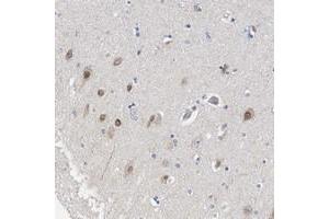 Immunohistochemical staining of human hippocampus with LRCH1 polyclonal antibody  shows distinct nuclear positivity in neuronal cells at 1:200-1:500 dilution.