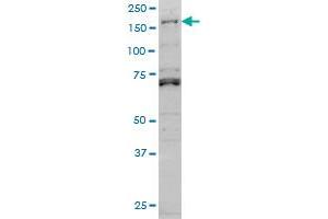 LMTK3 monoclonal antibody (M02A), clone 2H6 Western Blot analysis of LMTK3 expression in Hela S3 NE . (LMTK3 antibody  (AA 1151-1250))