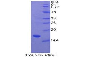 SDS-PAGE (SDS) image for Superoxide Dismutase 1, Soluble (SOD1) (AA 2-152) protein (His tag) (ABIN1080855) (SOD1 Protein (AA 2-152) (His tag))