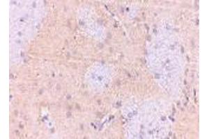 Immunohistochemistry of GPAT1 in rat brain with GPAT1 antibody at 2. (GPAM antibody  (C-Term))