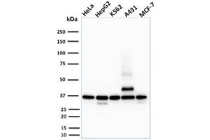 Western Blot Analysis of HeLa, HepG2, K562, A431 and MCF-7 cell lysate using RAD51 Mouse Monoclonal Antibody (RAD51/2701). (RAD51 antibody  (AA 1-134))
