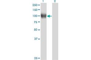 Western Blot analysis of NR3C1 expression in transfected 293T cell line by NR3C1 monoclonal antibody (M01), clone 2C8. (Glucocorticoid Receptor antibody  (AA 51-140))
