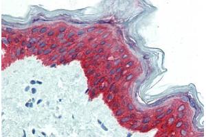 Skin, Human: Formalin-Fixed, Paraffin-Embedded (FFPE) (KRT14 antibody  (C-Term))