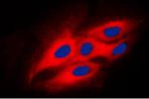 Immunofluorescent analysis of Beta-glucosidase 2 staining in HeLa cells. (GBA2 antibody  (Center))