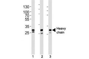 Western blot analysis of lysate from (1) A431, (2) MCF-7, (3) SK-BR-3 cell line using Cathepsin D antibody at 1:1000. (Cathepsin D antibody  (Heavy Chain))