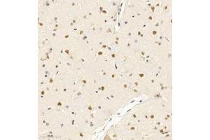 Immunohistochemistry of paraffin embedded rat brain using SOCS7 (ABIN7075765) at dilution of 1:650 (300x lens)