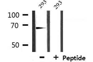 Western blot analysis of extracts from 293, using Involucrin Antibody.