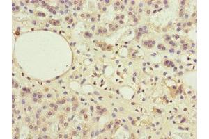 Immunohistochemistry of paraffin-embedded human adrenal gland tissue using ABIN7169283 at dilution of 1:100 (PPP2R3B antibody  (Regulatory Subunit B))