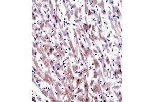 Immunohistochemistry (IHC) image for anti-Egl-9 Family Hypoxia Inducible Factor 3 (EGLN3) antibody (ABIN2997822) (EGLN3 antibody)