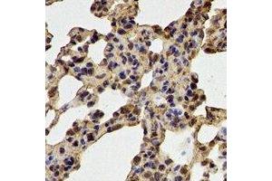 Immunohistochemical analysis of Glutathione Synthetase staining in mouse lung formalin fixed paraffin embedded tissue section. (Glutathione Synthetase antibody)