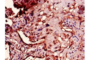 Immunohistochemistry of paraffin-embedded human placenta tissue using ABIN7166476 at dilution of 1:100 (PTMA antibody  (AA 5-110))