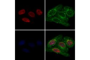 ABIN7093969 and ABIN7098013 staining Hela cells by IF/ICC.