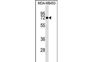 ZFP57 antibody  (N-Term)