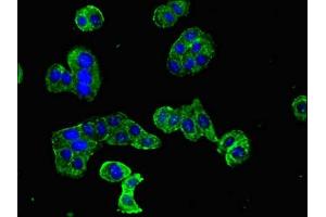 Immunofluorescent analysis of HepG2 cells using ABIN7150615 at dilution of 1:100 and Alexa Fluor 488-congugated AffiniPure Goat Anti-Rabbit IgG(H+L) (DOC2B antibody  (AA 7-180))