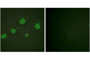 Immunofluorescence analysis of HuvEc cells, using GATA3 (Phospho-Ser308) Antibody.