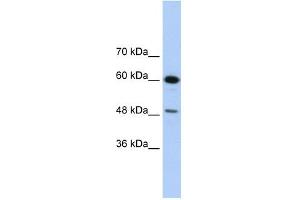 WB Suggested Anti-DAZAP1 Antibody Titration:  1. (DAZAP1 antibody  (C-Term))