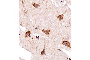 Immunohistochemical analysis of paraffin-embedded H. (GPR58 antibody  (N-Term))