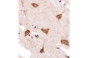 Immunohistochemical analysis of paraffin-embedded H. (GPR58 antibody  (N-Term))