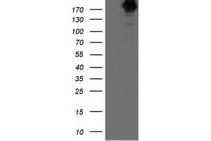 Image no. 1 for anti-SNF2 Histone Linker PHD RING Helicase, E3 Ubiquitin Protein Ligase (SHPRH) (AA 1-100) antibody (ABIN1490551) (SHPRH antibody  (AA 1-100))