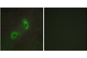 Immunofluorescence analysis of HUVEC cells, using HGS antibody. (HGS antibody)