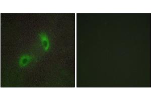 Immunofluorescence analysis of HUVEC cells, using HGS antibody. (HGS antibody)