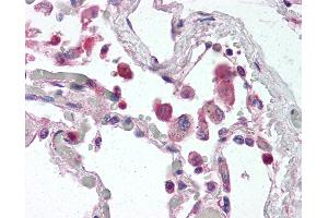 Anti-TLR9 antibody IHC of human lung. (TLR9 antibody  (AA 268-284))