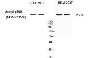 Western Blot (WB) analysis of HeLa 293T using EP300 antibody. (p300 antibody)