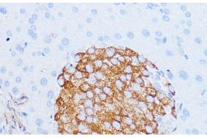 Immunohistochemistry of paraffin-embedded Mouse pancreas using NOTCH3 Polyclonal Antibody at dilution of 1:100 (40x lens). (NOTCH3 antibody)