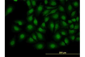 Immunofluorescence of monoclonal antibody to TRIB3 on HeLa cell. (TRIB3 antibody  (AA 56-145))