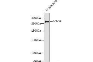 Western blot analysis of extracts of Mouse lung using SCN5A Polyclonal Antibody at dilution of 1:1000. (SCN5A antibody)