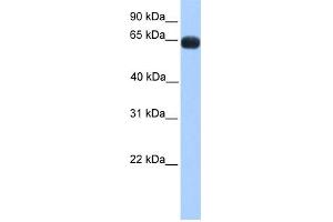 WB Suggested Anti-ZNF100 Antibody Titration:  0.