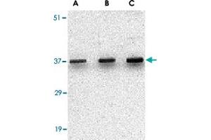 Western blot analysis of UNG in C2C12 cell lysate with UNG polyclonal antibody  at (A) 0. (UNG antibody  (C-Term))