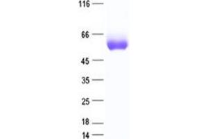 Validation with Western Blot (IL1RL1 Protein (His tag))
