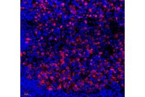 Immunofluorescence of paraffin embedded mouse lymph node using SLBP (ABIN7075733) at dilution of 1: 650 (400x lens) (SLBP antibody)