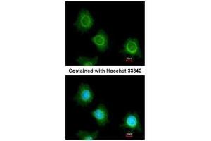 ICC/IF Image Immunofluorescence analysis of methanol-fixed HeLa, using PF4V1, antibody at 1:200 dilution. (PF4V1 antibody  (C-Term))