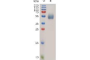 SDS-PAGE (SDS) image for Interleukin 1 Receptor, Type II (IL1R2) (AA 14-343) protein (His tag) (ABIN7490919)