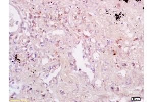 Formalin-fixed and paraffin embedded human kidney labeled with Anti-CD74/MHC II Polyclonal Antibody, Unconjugated (ABIN741435) at 1:200 followed by conjugation to the secondary antibody and DAB staining. (CD74 antibody  (AA 151-250))