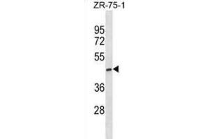 Western Blotting (WB) image for anti-ST6 (Alpha-N-Acetyl-Neuraminyl-2,3-beta-Galactosyl-1,3)-N-Acetylgalactosaminide alpha-2,6-Sialyltransferase 5 (ST6GALNAC5) antibody (ABIN3000960)