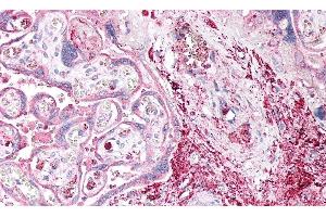 Detection of ENTPD1 in Human Placenta Tissue using Polyclonal Antibody to Ectonucleoside Triphosphate Diphosphohydrolase 1 (ENTPD1) (CD39 antibody  (AA 241-486))