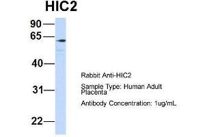 Host:  Rabbit  Target Name:  HIC2  Sample Type:  Human Adult Placenta  Antibody Dilution:  1. (HIC2 antibody  (Middle Region))