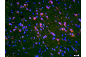 Formalin-fixed and paraffin-embedded rat brain labeled with Anti-PMP2 Polyclonal Antibody, Unconjugated (ABIN676823) 1:200, overnight at 4°C, The secondary antibody was Goat Anti-Rabbit IgG, Cy3 conjugated used at 1:200 dilution for 40 minutes at 37°C.