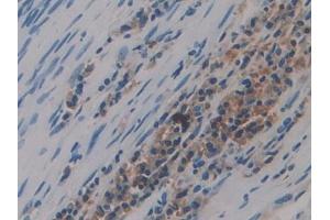 DAB staining on IHC-P;;Samples: Human Lung Tissue (Preprovasopressin (AA 21-164) antibody)