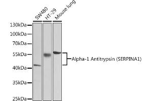 Western blot analysis of extracts of various cell lines, using Alpha-1 Antitrypsin (Alpha-1 Antitrypsin (SERPIN)) antibody (2481) at 1:1000 dilution. (SERPINA1 antibody  (AA 25-315))